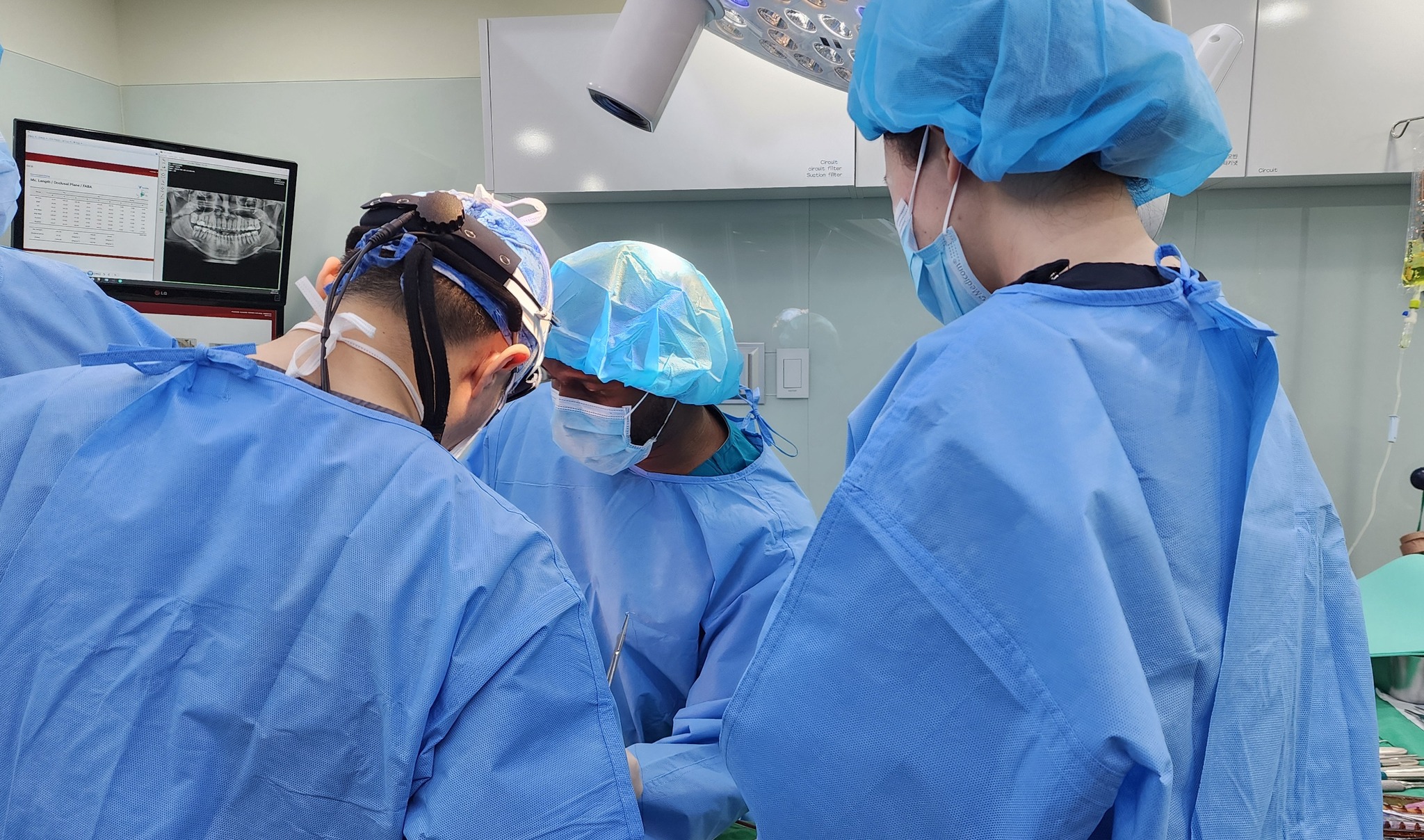 Surgical team operating beside a monitor showing a panoramic jaw X-ray and cephalometric measurements